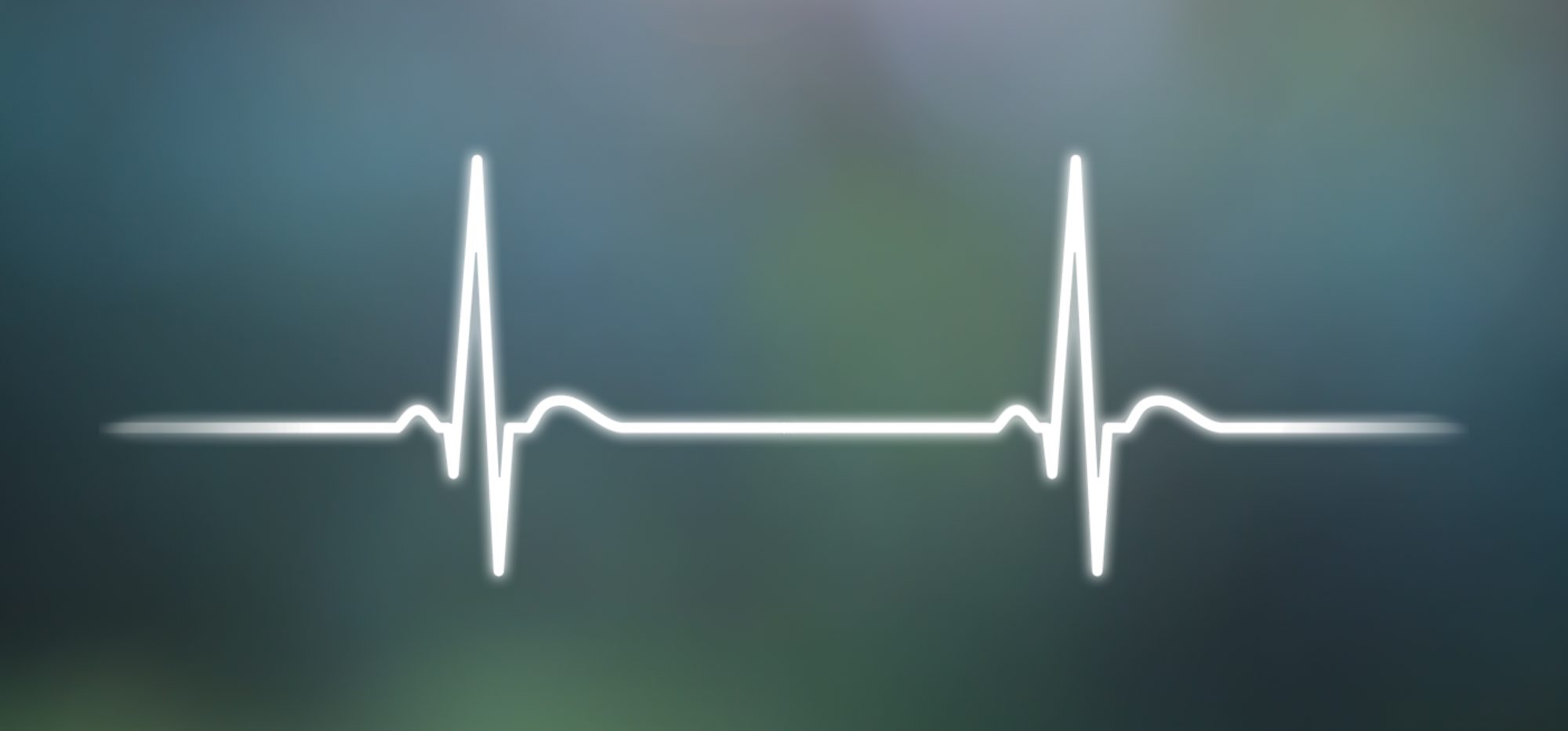 Featured image for “De ce este utila o monitorizare Holter EKG”